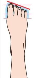 1913b5731a53ad6dee-74481021