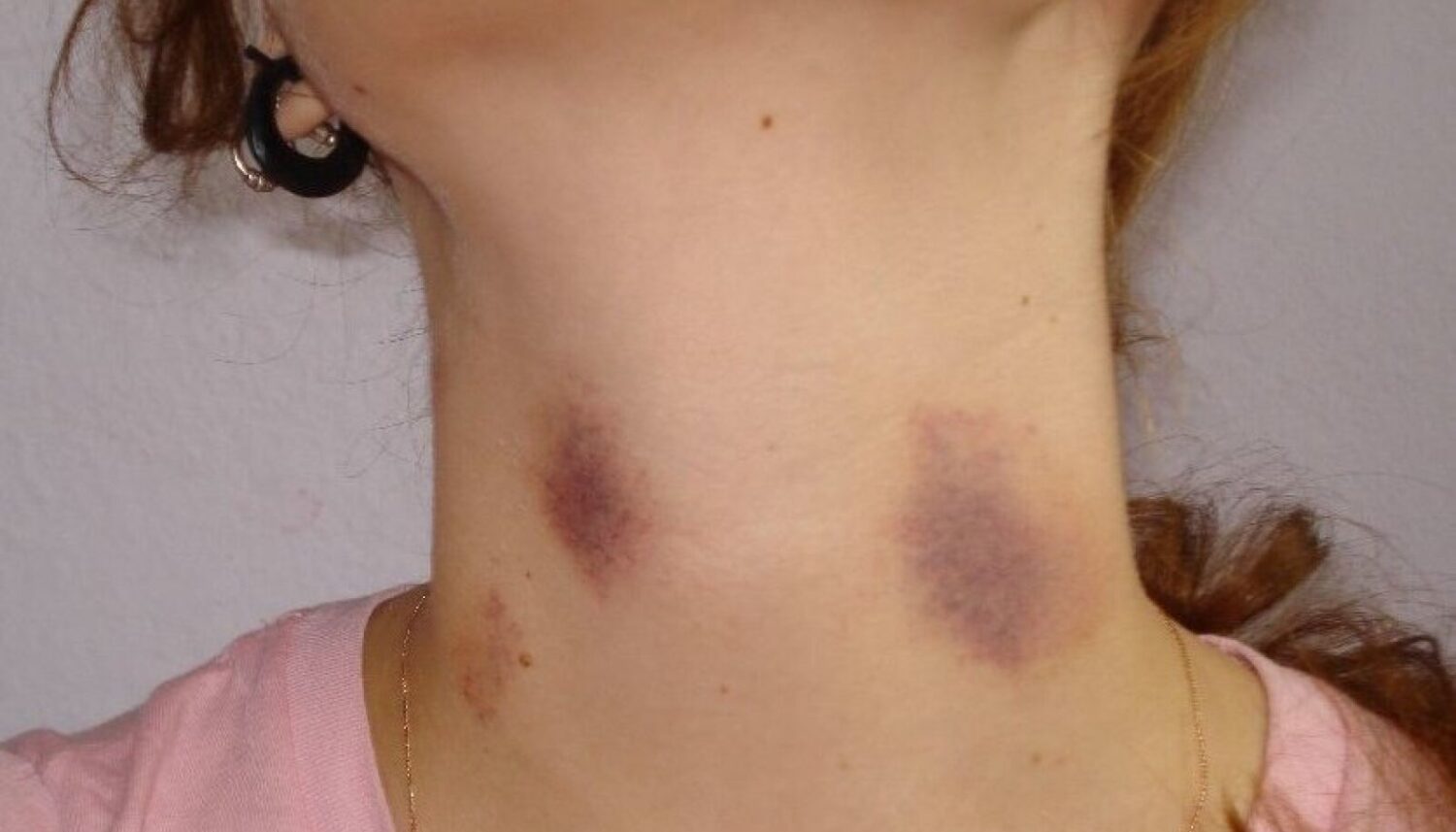 9a1f857cd77d45225e-75534863