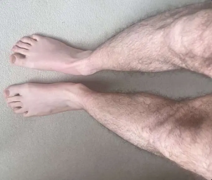 raising-awareness-of-l